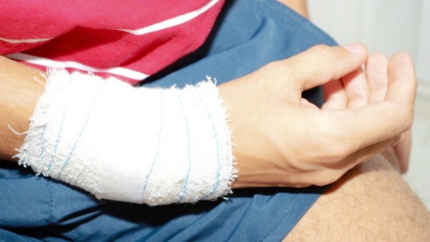 Jovem diz que foi agredido em festa em 2012 em Novo Hamburgo (Foto: Jeferson Paz/Arquivo pessoal)