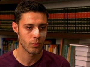 Luís Alberto foi agredido quando tinha 23 anos (Foto: Reprodução/ TV Globo)